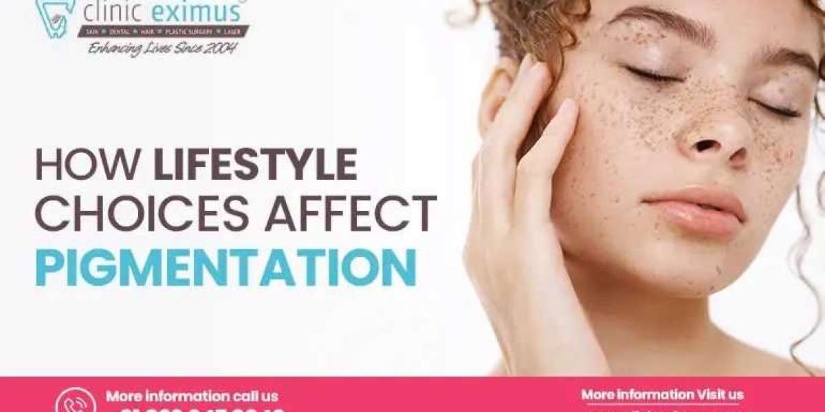 PRF Treatment in Delhi and Best Pigmentation Treatment in Delhi at Clinic Eximus