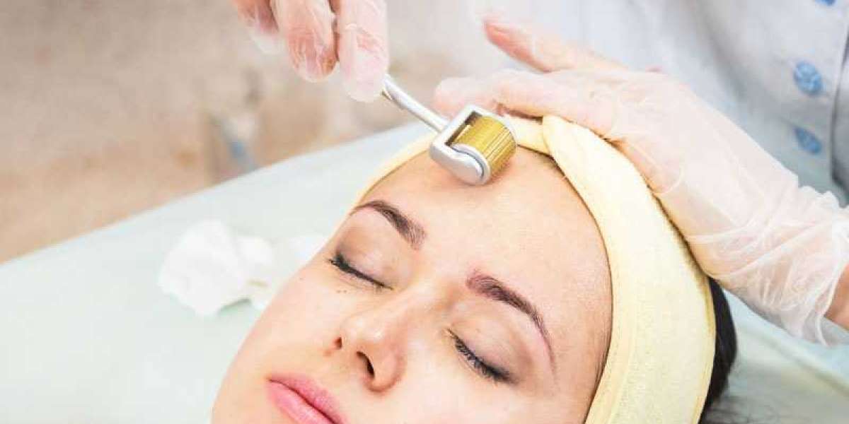 Collagen Induction Therapy: Microneedling Treatment in Delhi at Derma Station