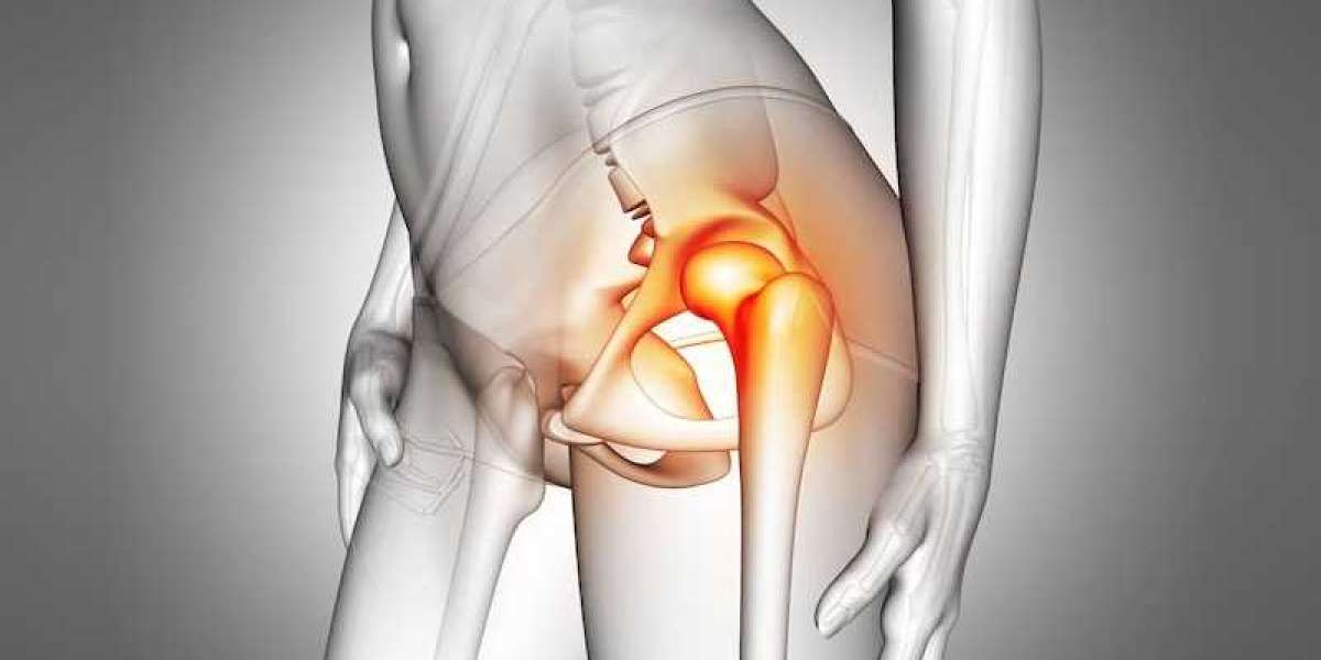 Expert Tips for Smooth Healing After Total Hip Replacement Surgery in Delhi