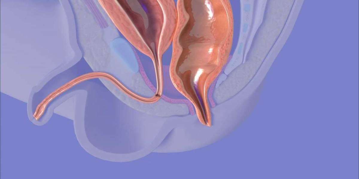 Advanced Pediatric Surgical Solutions for Anorectal Malformation in India