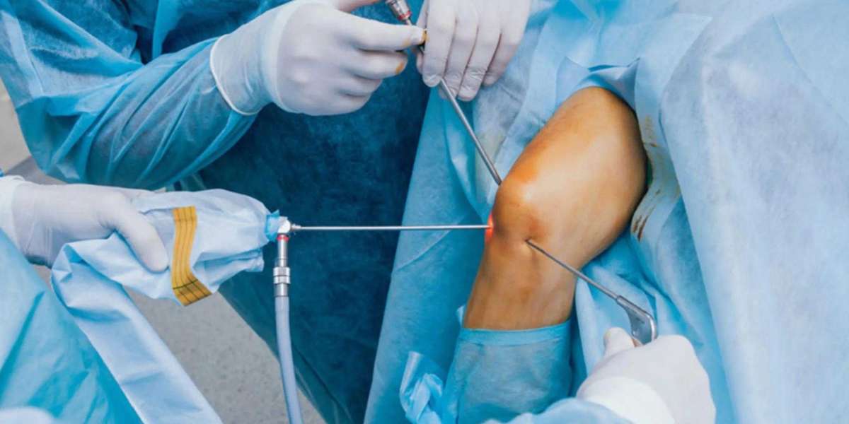 Arthroscopy Surgery Delhi: Quick Recovery with Minimally Invasive Techniques