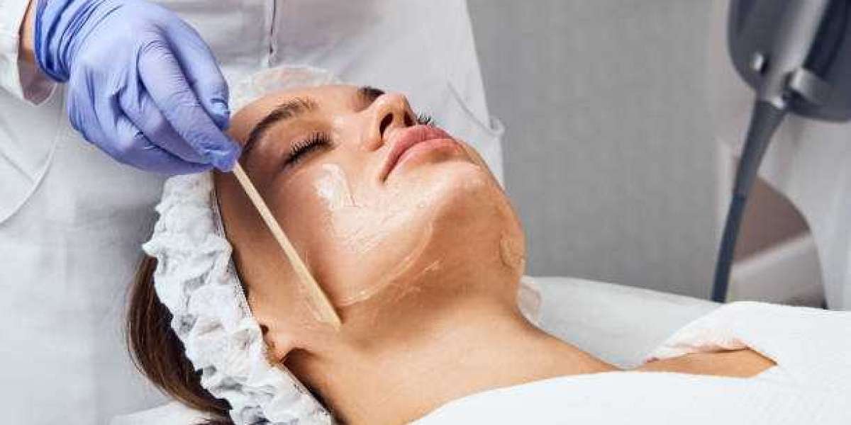 Discover the Benefits of Chemical Peels in Riyadh for Flawless Skin