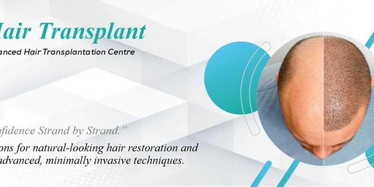 Recovery Tips After FUE Hair Transplant